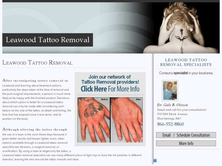 www.leawoodtattooremoval.com