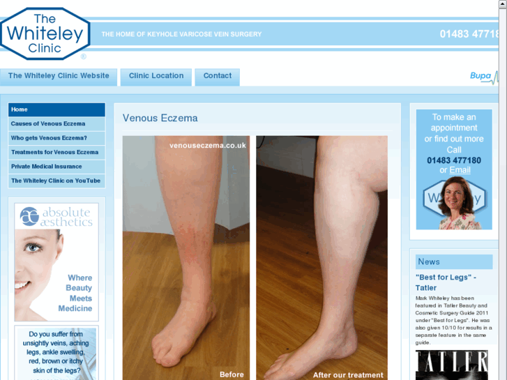 www.venous-eczema.com