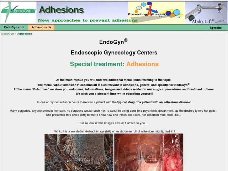 www.adhesionssurgery.com