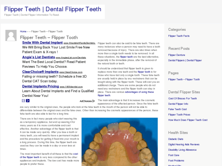 www.flipperteeth.com