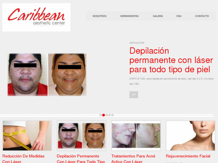 www.caribbeanlaser.com