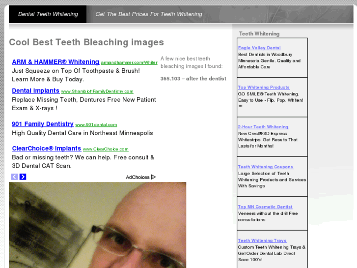 www.dentalteethwhitenings.com