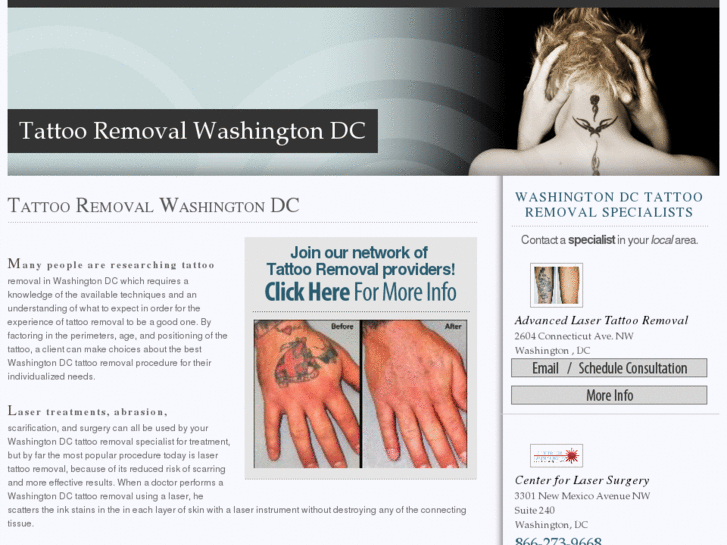 www.tattooremovalwashingtondc.com