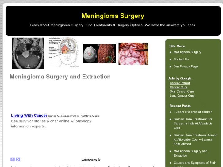 www.meningiomasurgery.net