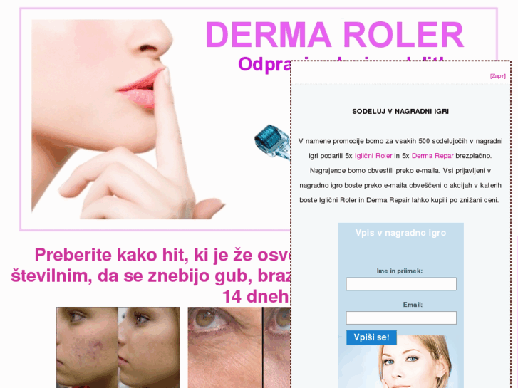 www.original-dermaroller.com