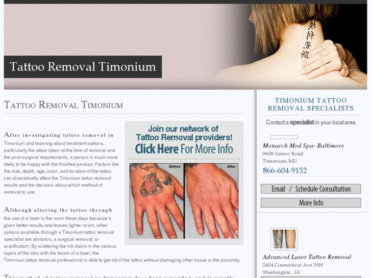 www.timoniumtattooremoval.com