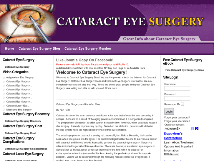 www.cataract-eye-surgery.com