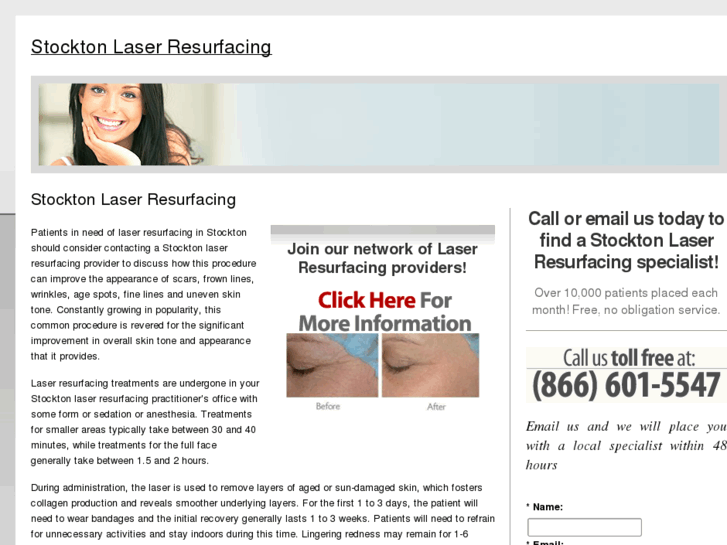 www.stocktonlaserresurfacing.com