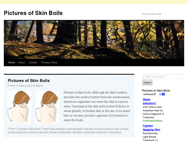www.picturesofskinboils.net