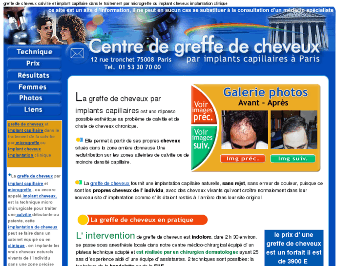 www.greffe-de-cheveux.biz