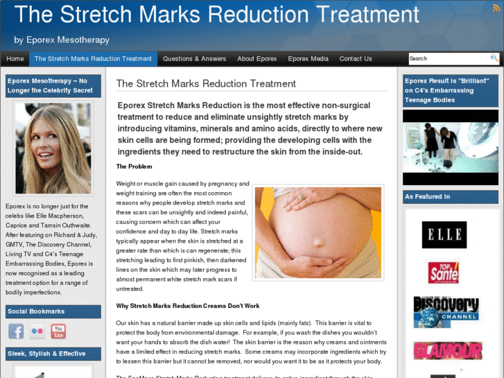 www.treatmentstretchmarks.com