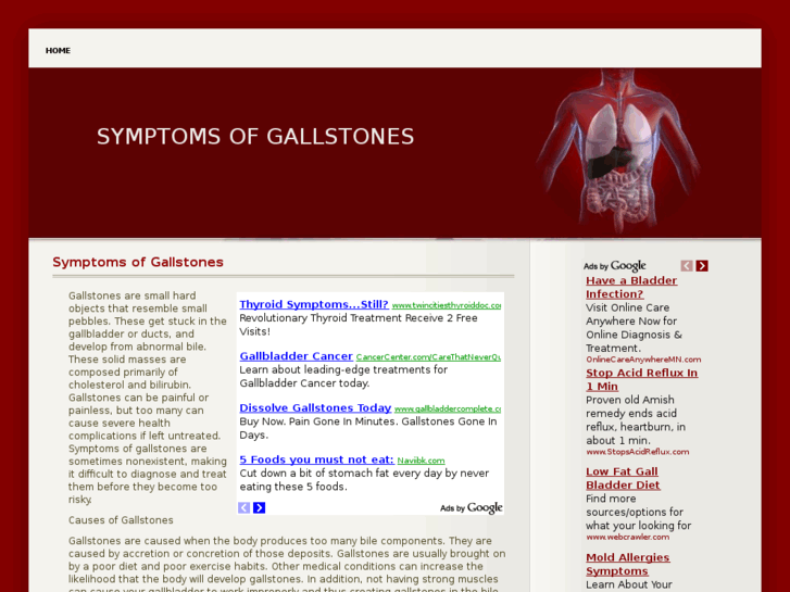 www.symptomsofgallstones.org