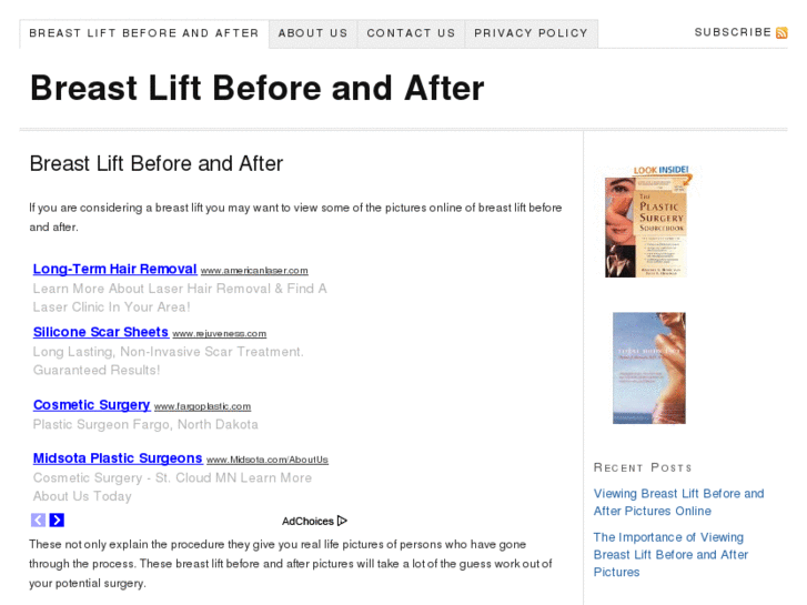 www.breastliftbeforeandafter.org