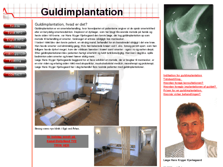 www.guldimplant.dk