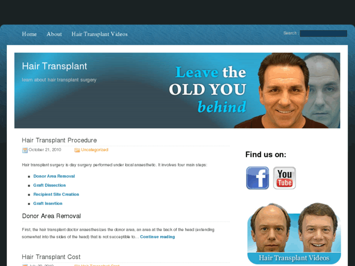 www.hairandtransplant.com