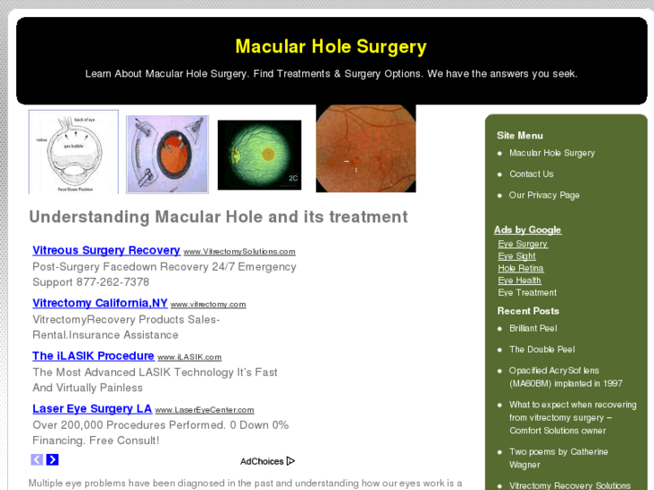 www.macularholesurgery.net