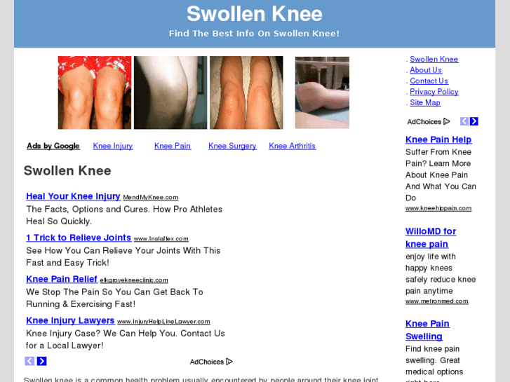 www.swollenknee.net