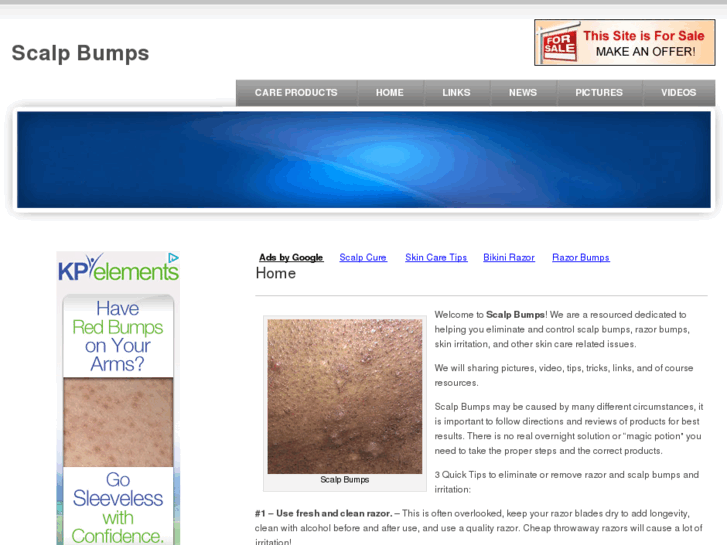 www.scalpbumps.com