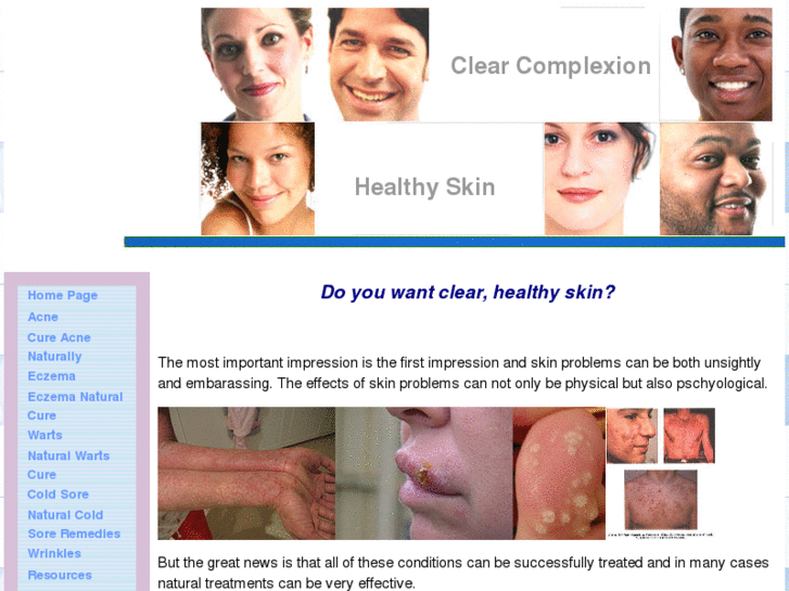 www.naturalskintreatmentguide.com