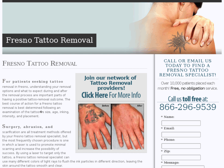 www.fresnotattooremoval.com