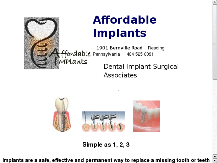 www.affordable-implants.net