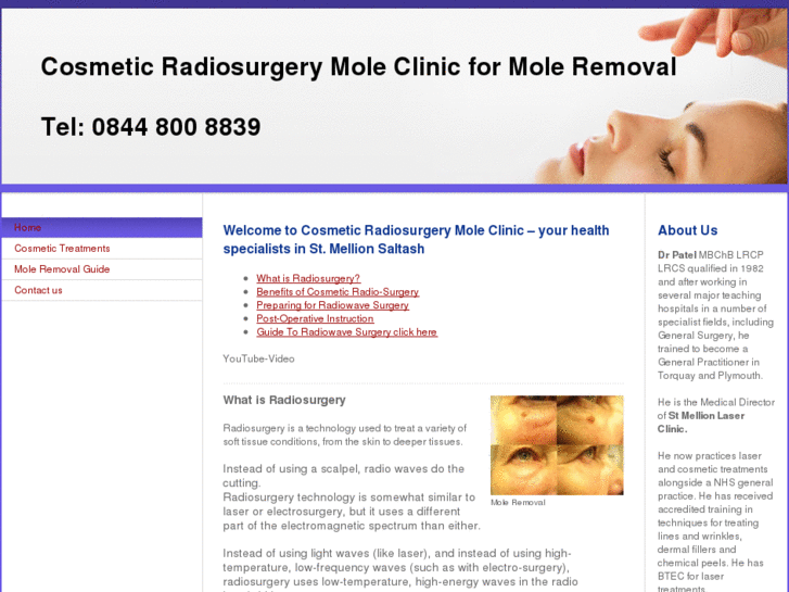 www.mole-radiosurgery.com