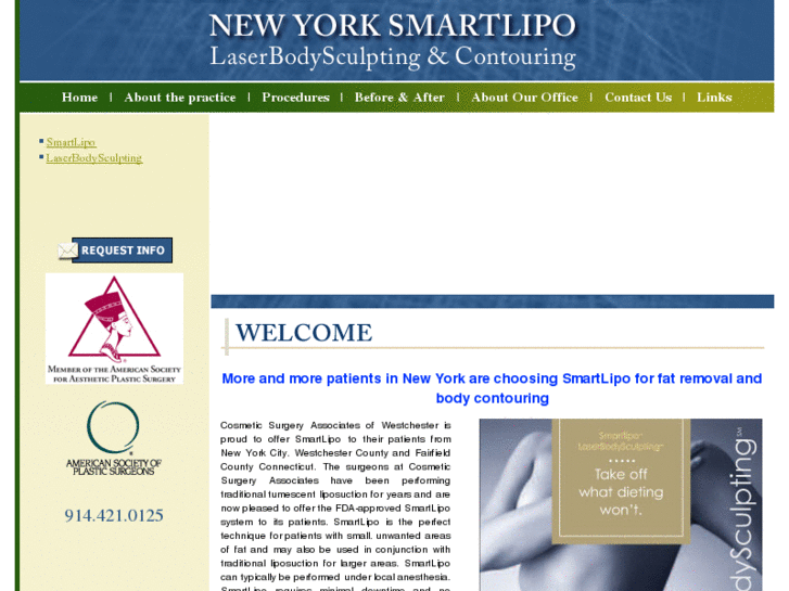 www.nycsmartlipo.com