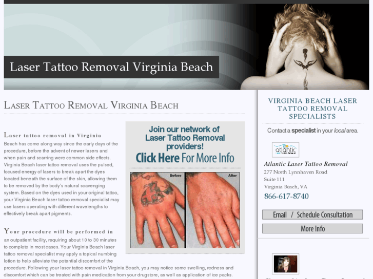 www.lasertattooremovalvirginiabeach.com