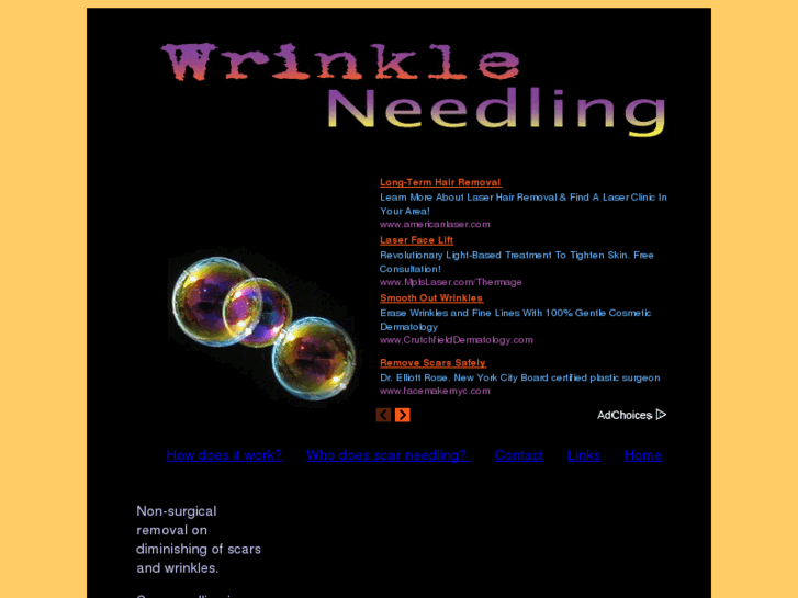 www.wrinkleneedling.com