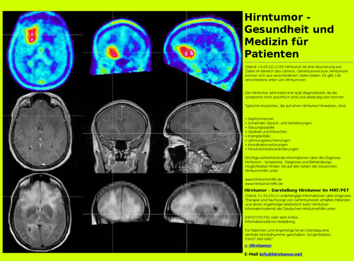 www.hirntumor.net