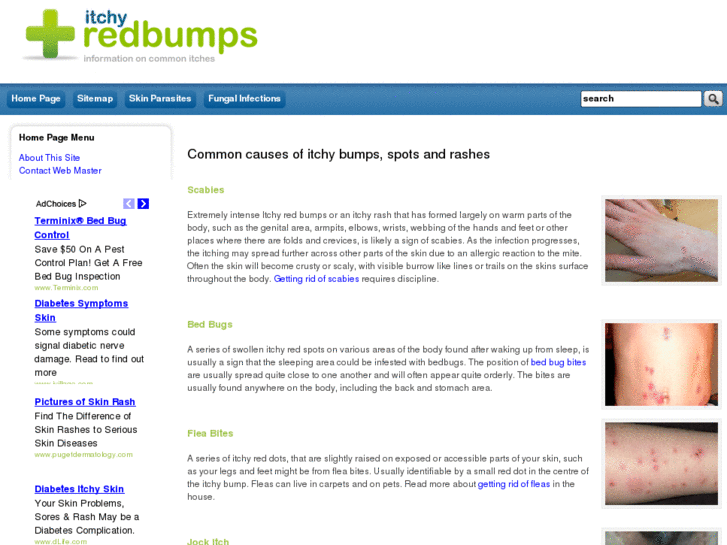 www.itchyredbumps.org