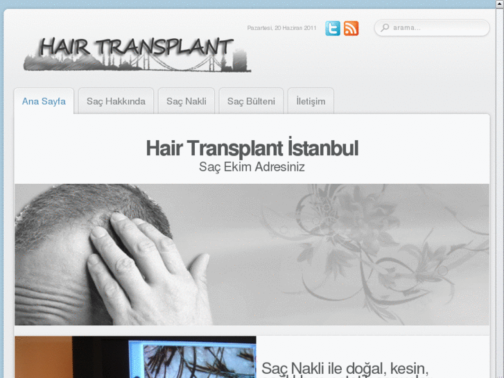 www.hairtransplantistanbul.com