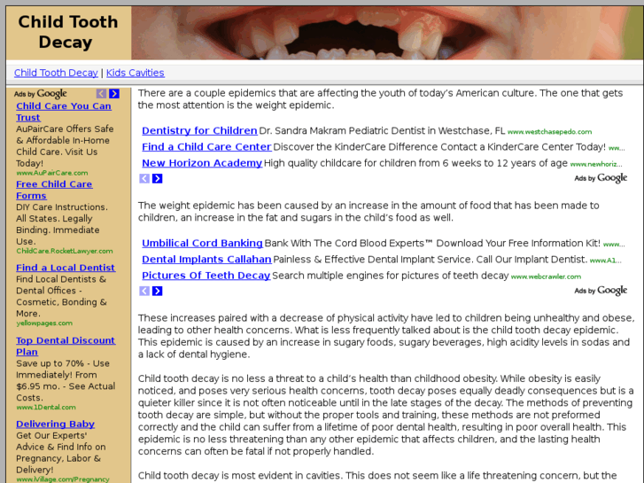 www.childtoothdecay.com