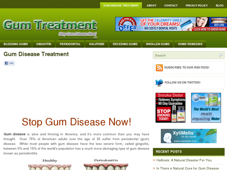 www.gumtreatment.net