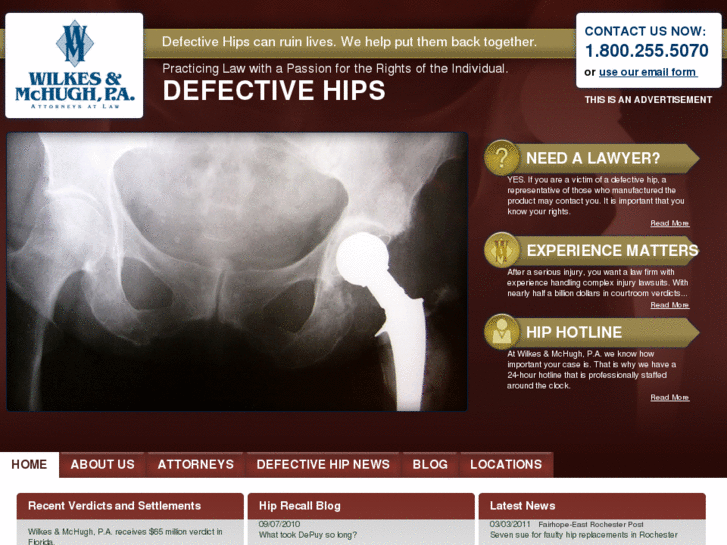 www.defectivehip.com