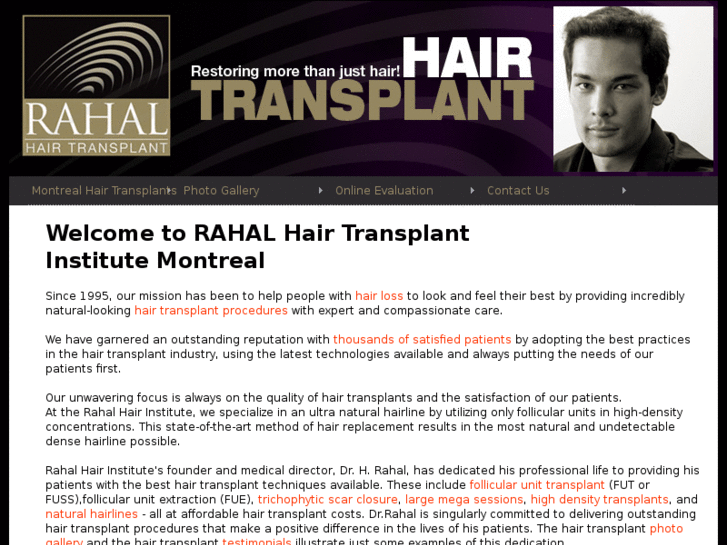 www.montrealhairtransplants.com