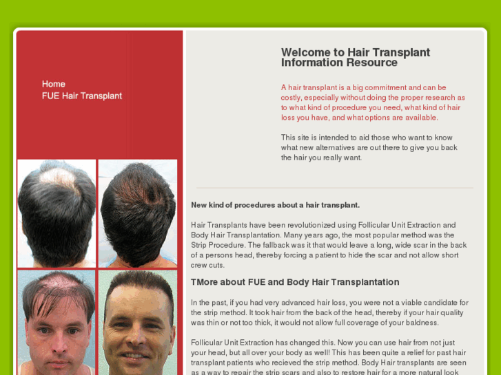 www.hairtransplant-info.net