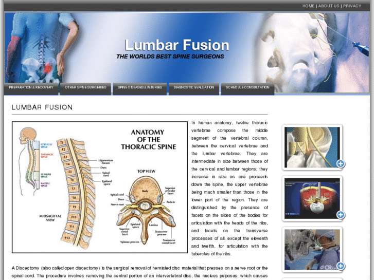 www.lumbarfusion.info