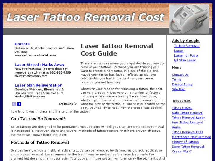 www.lasertattooremovalcost.net