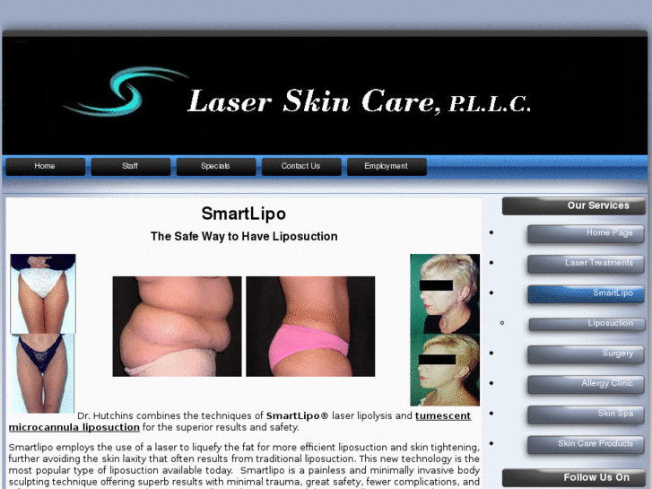 www.liposuctioncarolina.com