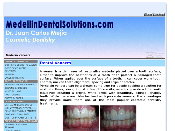 www.medellinveneers.com