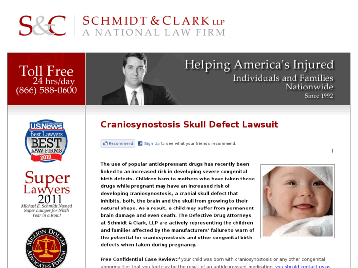 www.craniosynostosislawsuit.com