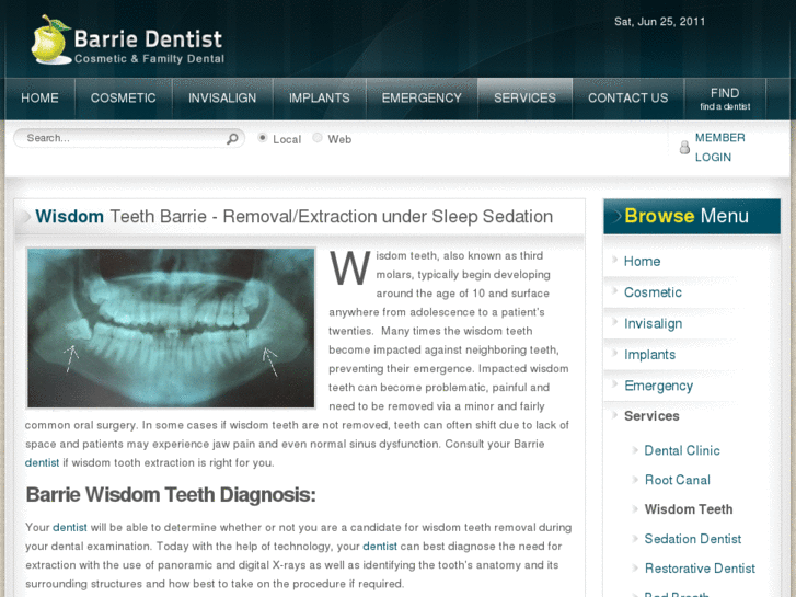 www.barriewisdomteeth.com