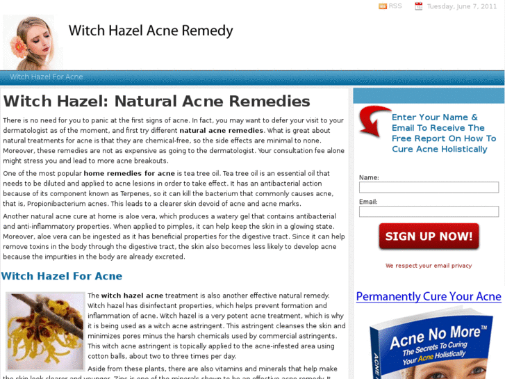 www.witchhazelacneremedy.com