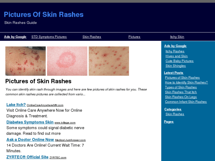 www.picturesofskinrashes.org