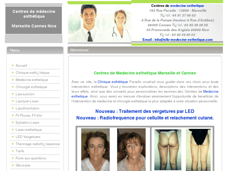 www.lipoplastie.com