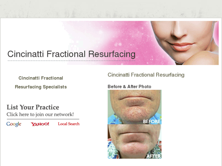 www.cincinattifractionalresurfacing.com