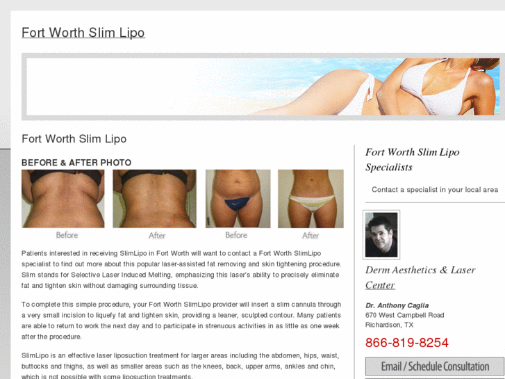 www.fortworthslimlipo.com