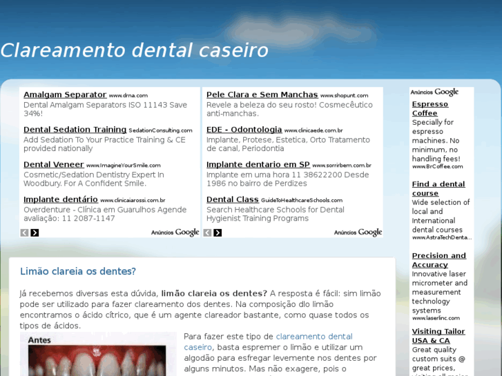 www.clareamentodentalcaseiro.com