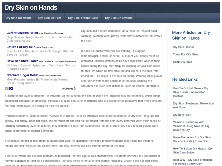 www.dryskinonhands.com